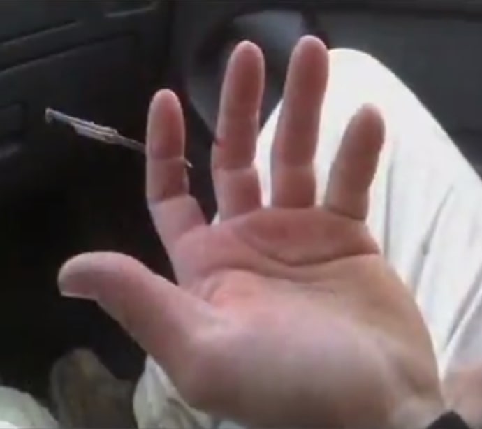Nail through finger